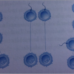 division ovulo gemelos monocigoticos mellizos dicigoticos gemelos de cuerpos polares